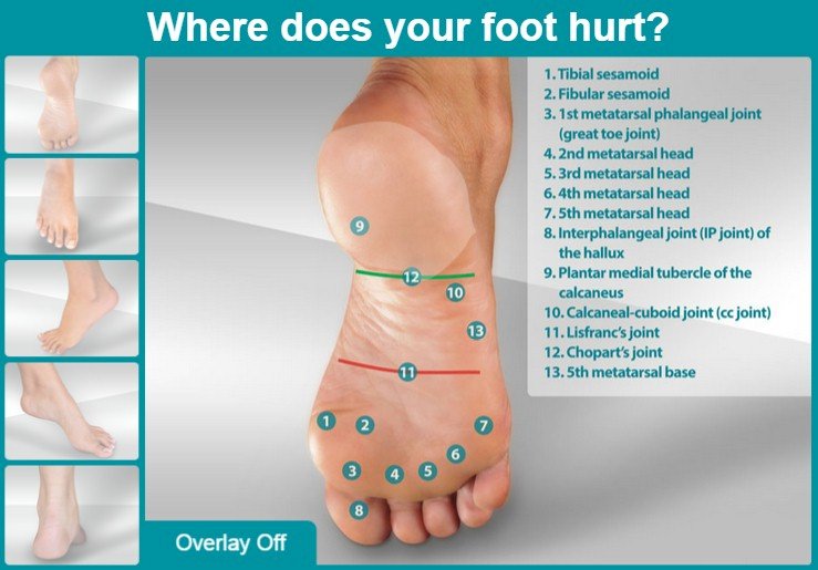 Foot diagnosis tool